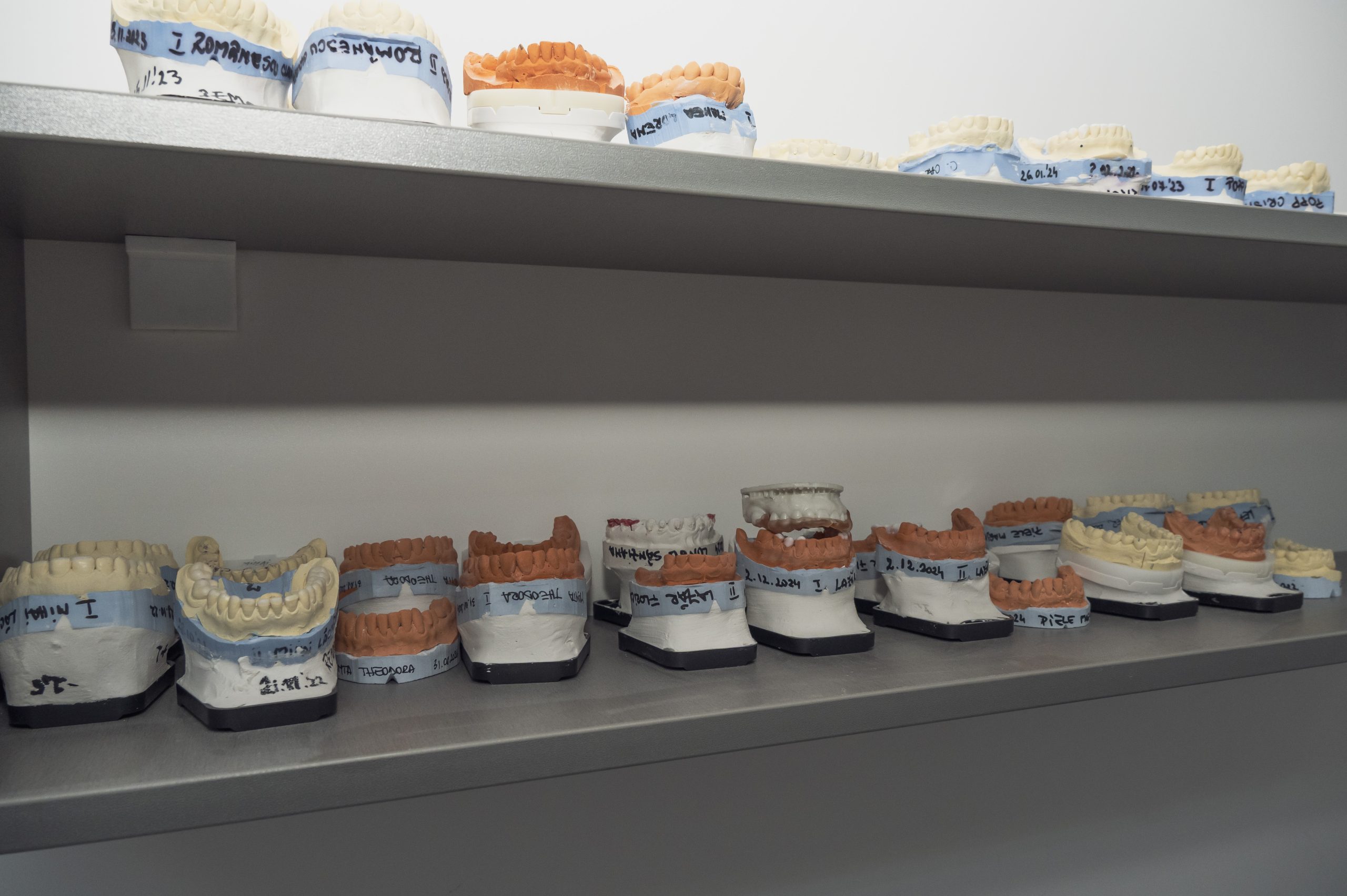 Patologia articulatiei temporo-mandibulare Patologia articulatiei temporo-mandibulare