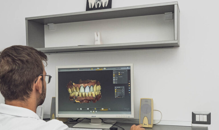 Analiza digitală a ocluziei pe scanare 3D a arcadelor, la HDS Câmpina