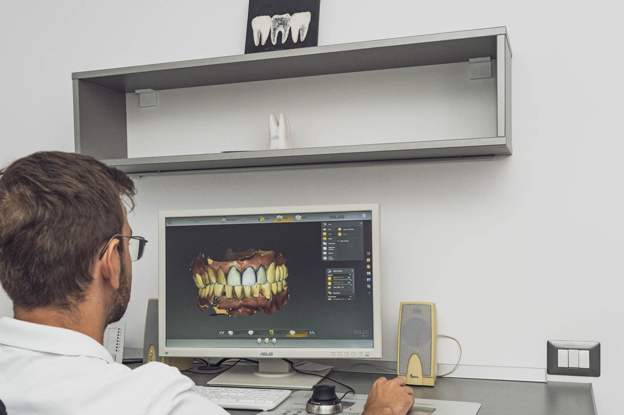 Gutieră ocluzală nocturnă tratament bruxism Câmpina