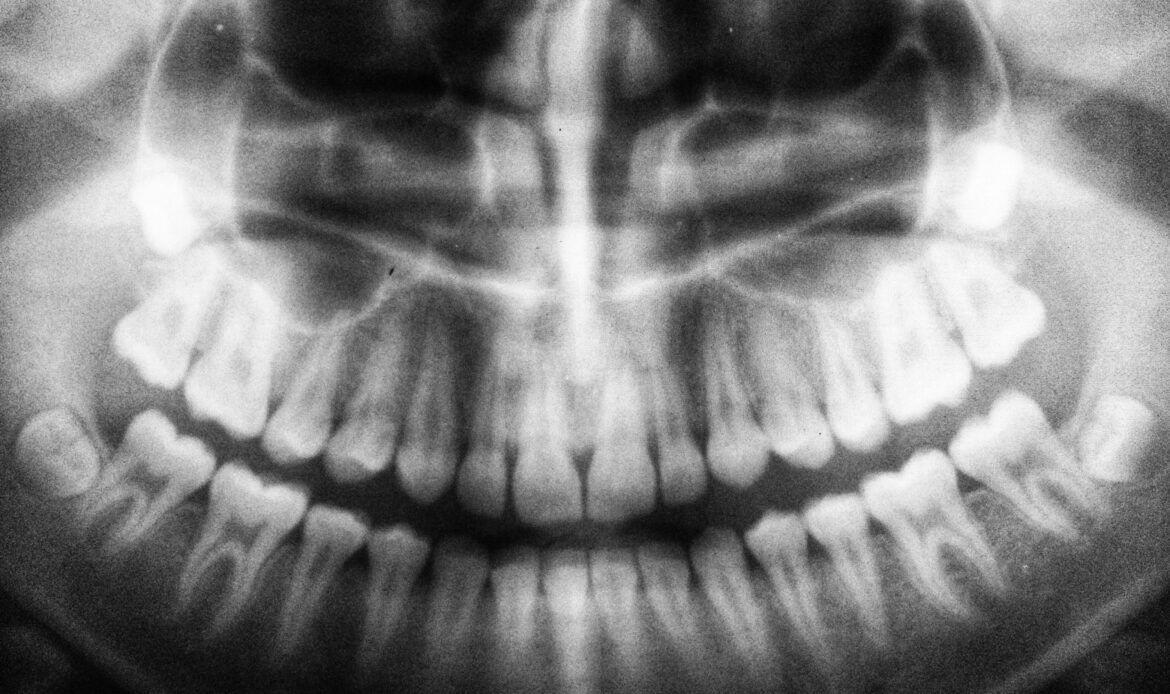 Radiografie Dentara Campina Dinti